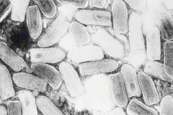 Imagen: Micrografía electrónica de barrido (SEM) que representa el rhabdovirus que produce la estomatitis vesicular (EV) en caballos, vacas y cerdos. Se utilizó un rhabdovirus inactivado en estudios recientes para destruir las células leucémicas (Fotografía cortesía de los Centros para el Control de Enfermedades de los EUA (CDC).